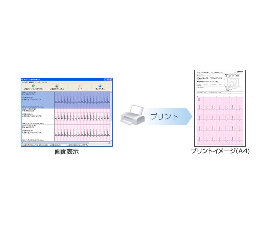 オムロン（ヘルスケア） 心電計 心電図印刷ソフト　HCG-SOFT-2 1個（ご注文単位1個）【直送品】