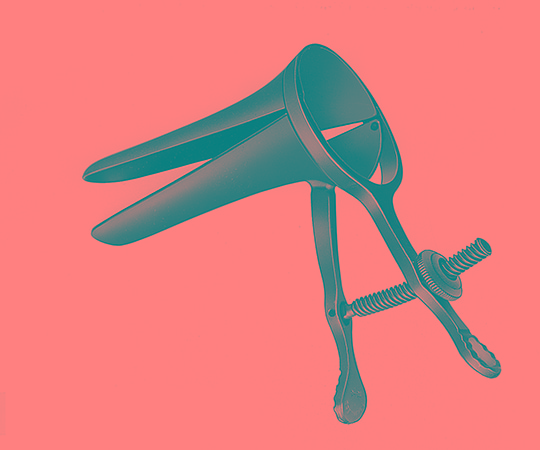 アトムメディカル クスコー・ブラック膣鏡 S コルポスコピー用18231 1個 (ご注文単位1個) 【直送品】