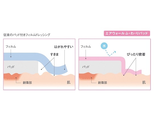 skinix エアウォールふ・わ・りパッド パッド付きフィルムドレッシング 100×135mm 30枚入YB-221014P 1箱 (ご注文単位1箱) 【直送品】