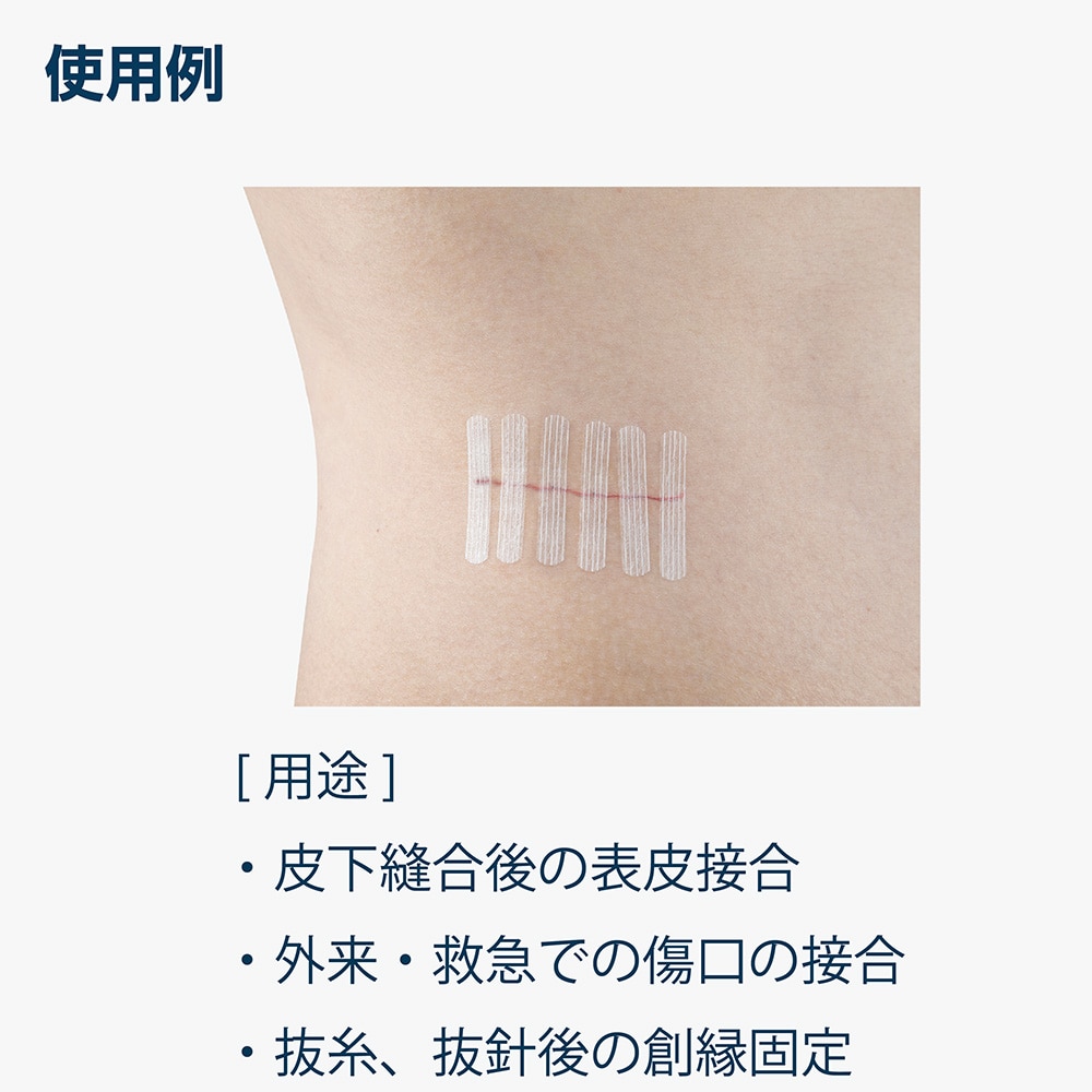 アズワン ナビストリップ (皮膚接合用テープ) 6×75mm 3本×10袋入SC675 1箱 (ご注文単位1箱) 【直送品】