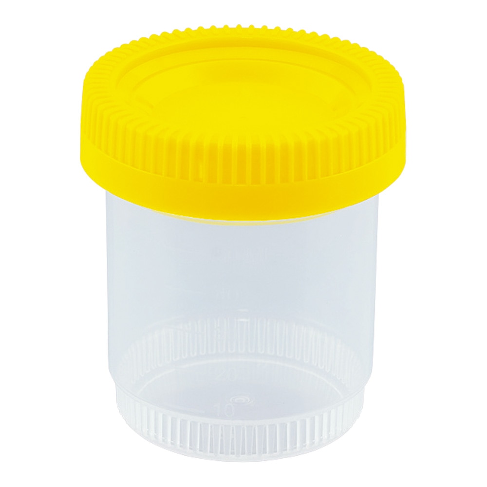 アズワン 標本容器 60mL フタ黄 1箱 (100個入) 1箱 (ご注文単位1箱) 【直送品】