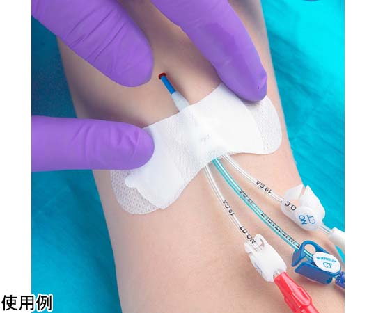 林寺メディノール カテーテル固定用パッチ グリップロック 汎用型・PICC固定用 100枚入 3300MWA 1箱（ご注文単位1箱）【直送品】