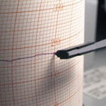 トラスコ中山 佐藤 カートリッジペン赤 1本 (7238-08)(ご注文単位1本)【直送品】