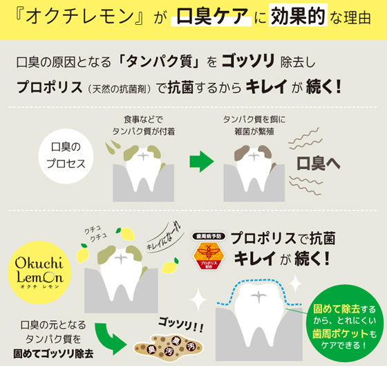 ビタットジャパン 爽快口内洗浄液 オクチレモン 1パック(ご注文単位1パック)【直送品】