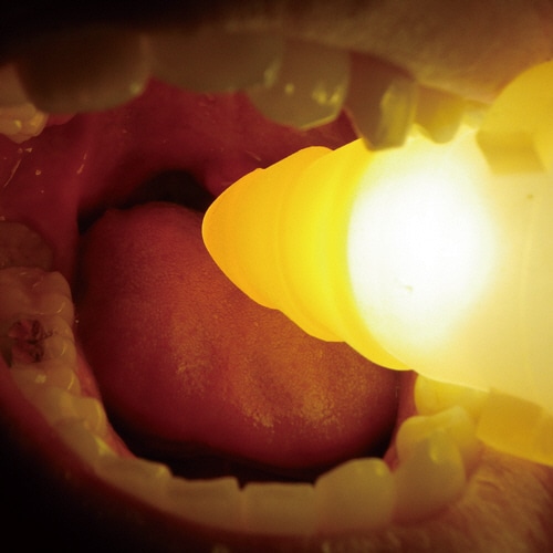 デントケア 口腔ケア用開口補助・保持具 バイトロックⅡ やわらかめ オレンジ DC-59OR 1個(ご注文単位1個)【直送品】