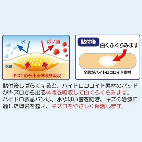 日進医療器 リーダー ハイドロ救急バン Mサイズ 徳用 1箱(100枚)/個(ご注文単位1個)【直送品】