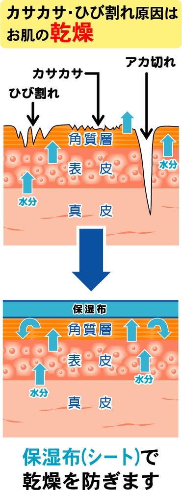 ミノウラ かかとツルツルサポーター ベージュ フリーサイズ 1個(ご注文単位1個)【直送品】