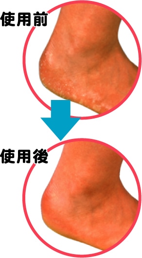 ミノウラ かかとツルツルサポーター ベージュ フリーサイズ 1個(ご注文単位1個)【直送品】