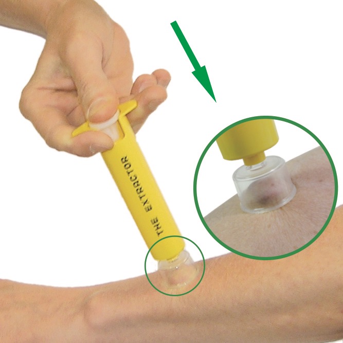 飯塚カンパニー エクストラクター ポイズンリムーバー 1個(ご注文単位1個)【直送品】